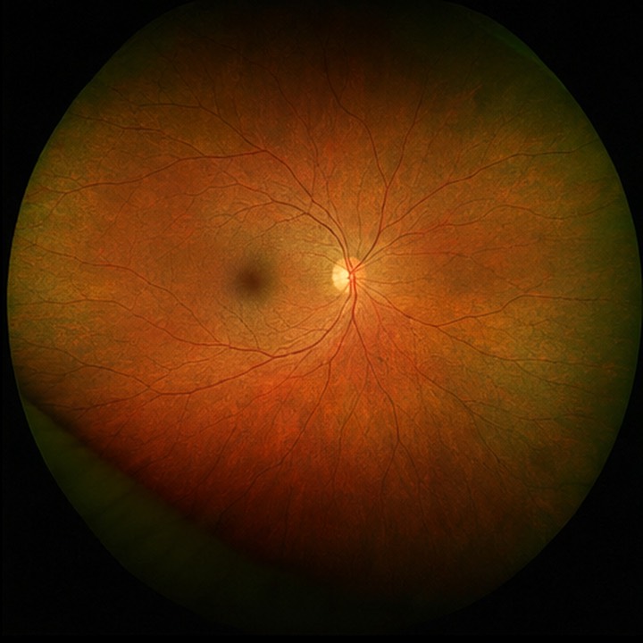 OD Ophthalmic Phot...